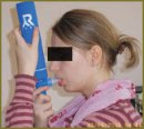 Содержание метаболитов оксида азота в конденсате выдыхаемого воздуха у детей с различным уровнем контроля бронхиальной астмы
