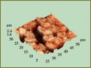 Морфофункциональный статус эритроцитов больных раком шейки матки после воздействия фемтосекундного лазерного излучения