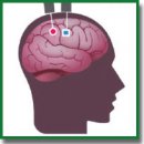 Нейрокомпьютерные интерфейсы с корковыми имплантатами для компенсации двигательной и коммуникативной функций: обзор последних достижений
