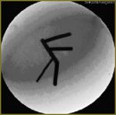 Методика пространственной реконструкции коронарного русла — способ предоперационной подготовки больных с ишемической болезнью сердца