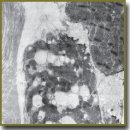 Влияние Мексидола на мозговой натрийуретический пептид кардиомиоцитов в постреперфузионном периоде в эксперименте