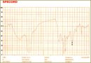 Определение химического состава желчных камней  у больных желчнокаменной болезнью с использованием метода инфракрасной спектрометрии
