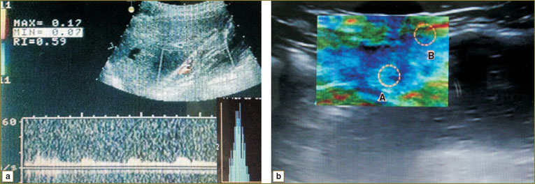 alieva-fig-4.jpg
