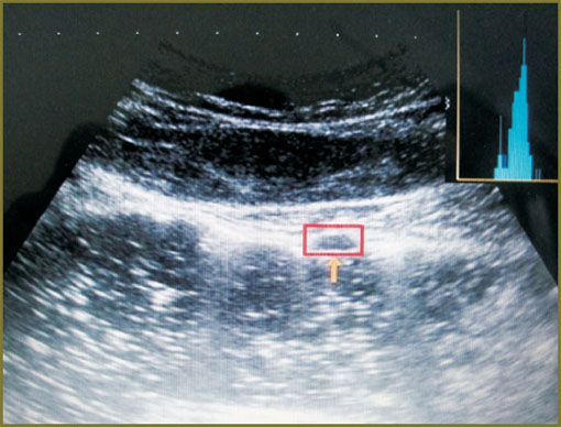 alieva-fig-8.jpg