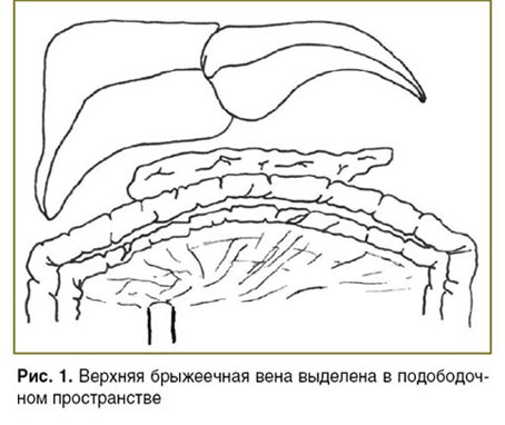 barvanyan-ris-1.jpg