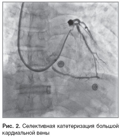 shakhov-ris-2.jpg