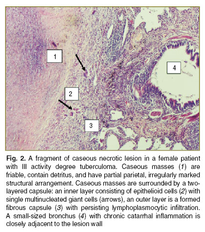 tlostanova-fig-2.jpg