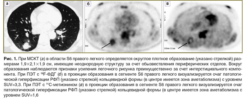 tlostanova-ris-1.jpg