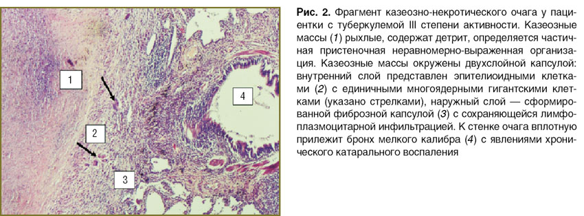 tlostanova-ris-2.jpg