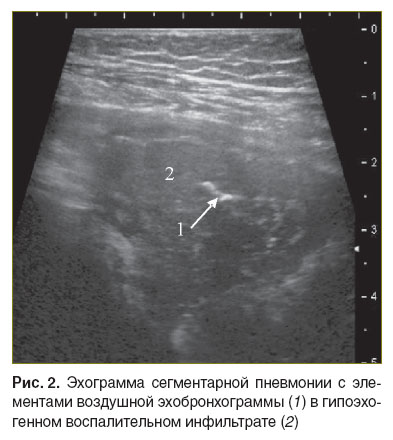 dianova-ris-2.jpg