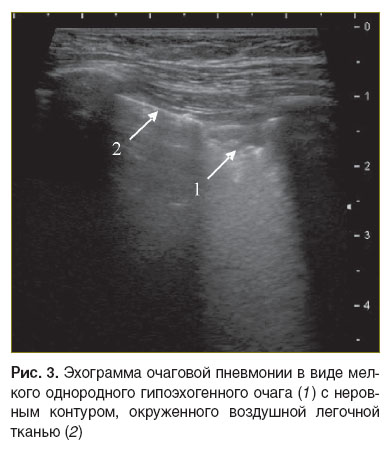 dianova-ris-3.jpg