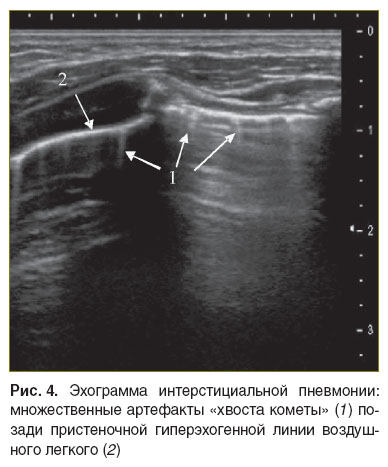 dianova-ris-4.jpg
