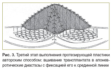 golovin-ris-3.jpg