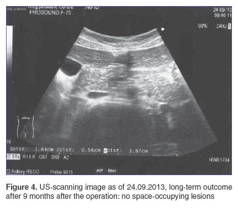 otdelnov-fig-4.jpg