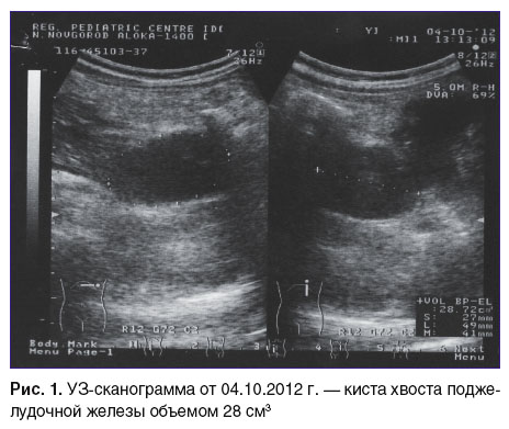 otdelnov-ris-1.jpg