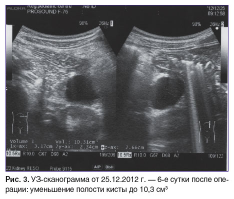 otdelnov-ris-3.jpg