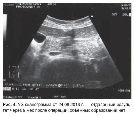 otdelnov-ris-4.jpg