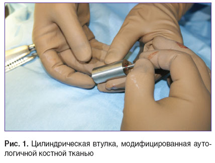 scherbovskih-ris-1.jpg