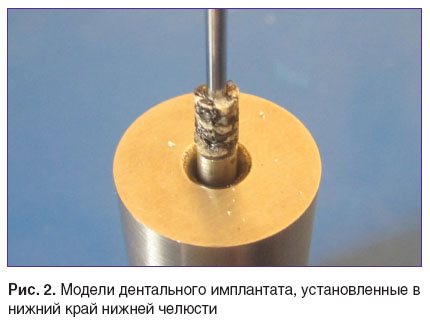 scherbovskih-ris-2.jpg