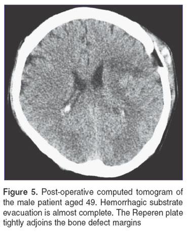 tikhomirov-fig-5.jpg