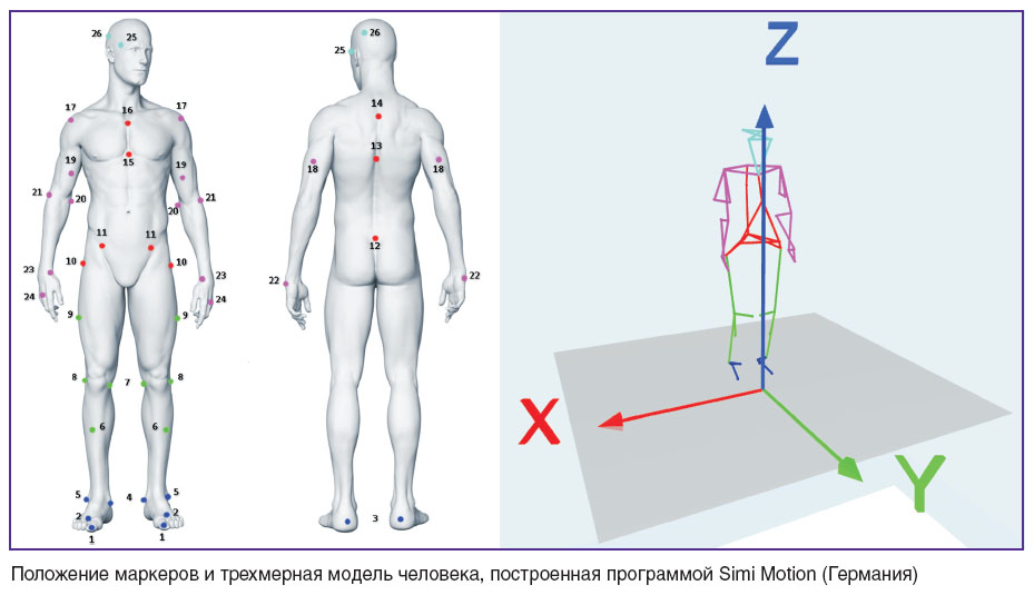 borzikov-ris.jpg