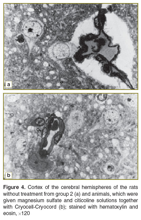 lychko-fig-4.jpg