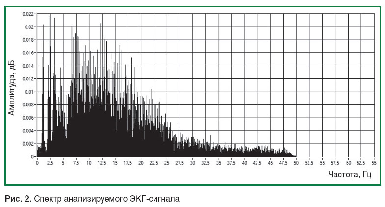 kuleshov-ris-2.jpg