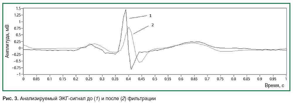 kuleshov-ris-3.jpg