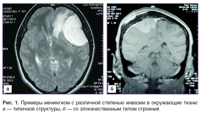 sheludyakov-ris-1.jpg
