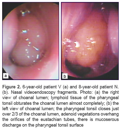 eliseeva-fig-2.jpg