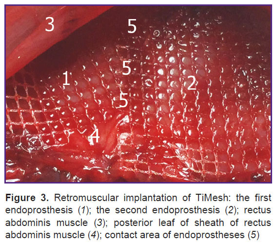 parshikov-fig-3.jpg