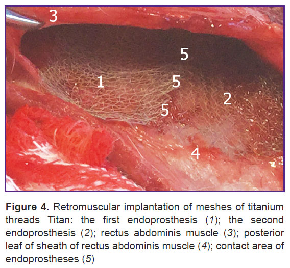 parshikov-fig-4.jpg