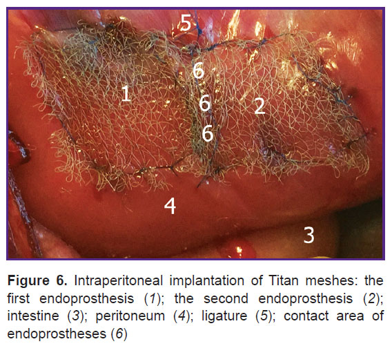 parshikov-fig-6.jpg