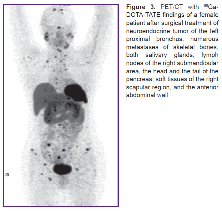 tlostanova-fig-3.jpg