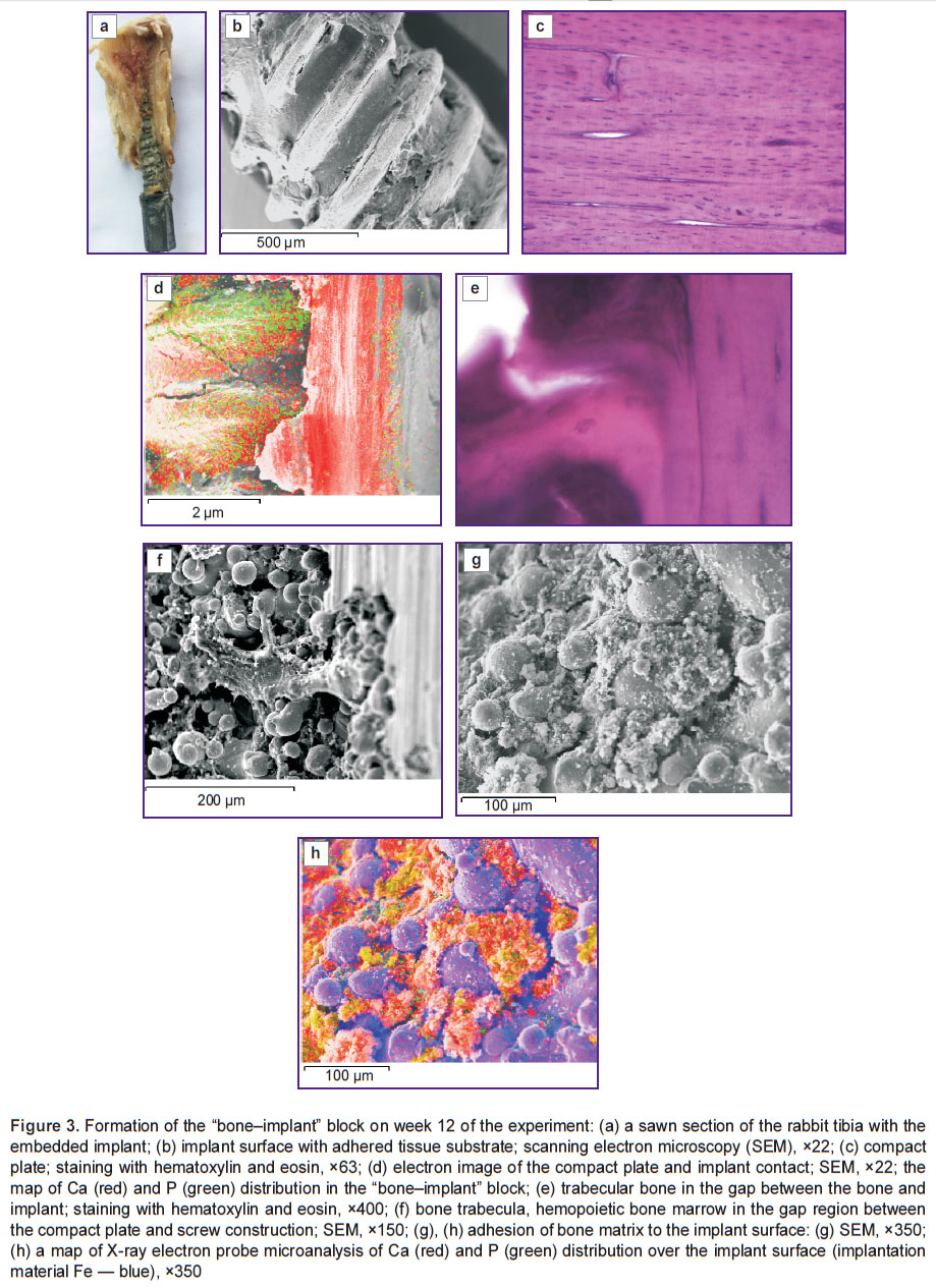 gorbach-fig-3.jpg