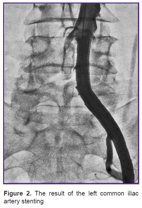 ishmetov-fig-2.jpg
