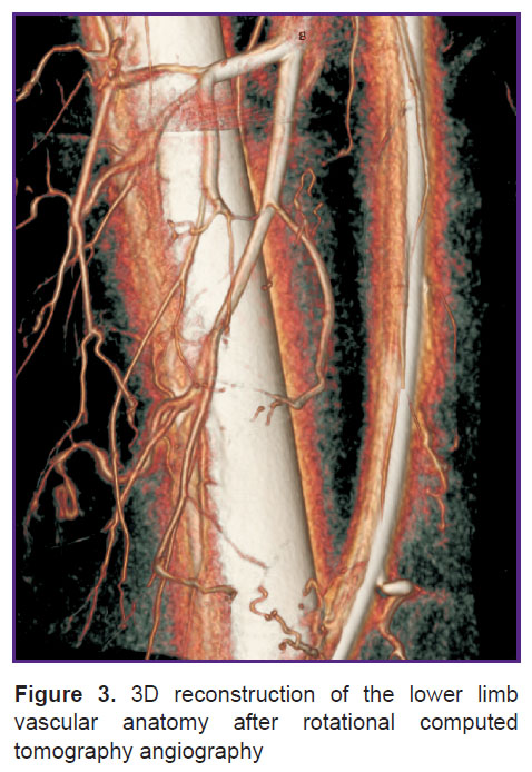 ishmetov-fig-3.jpg