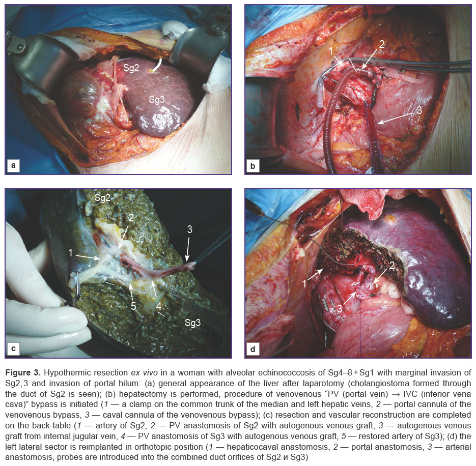 porshenikov-fig-3.jpg