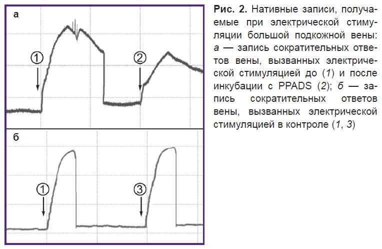 ziganshin-ris-2.jpg