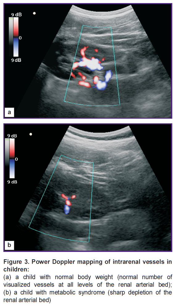 bekezin-fig-3.jpg