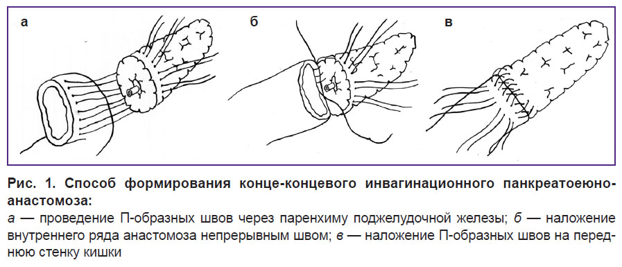 barvanyan-ris-1.jpg