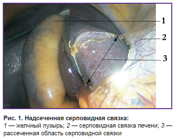 gorpinyuk-ris-1.jpg