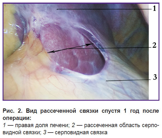 gorpinyuk-ris-2.jpg