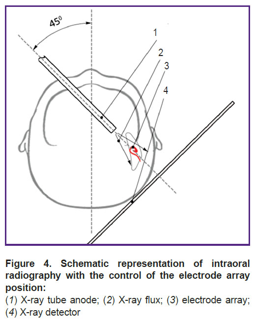 sokolova-fig-4.jpg