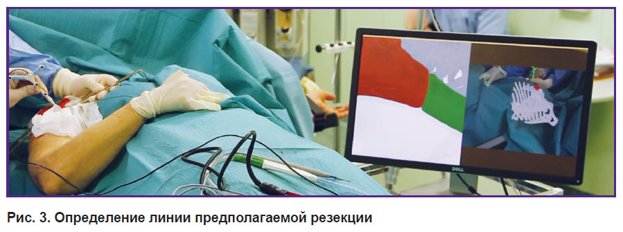 prikhodko-ris-3.jpg