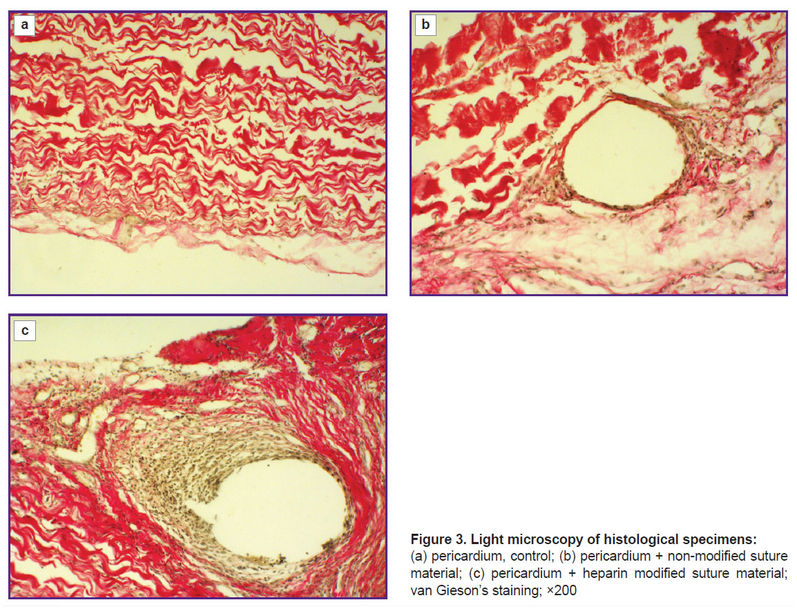 akentyeva-fig-3.jpg