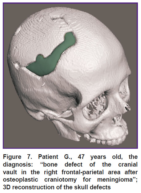 kolmogorov-fig-7.jpg