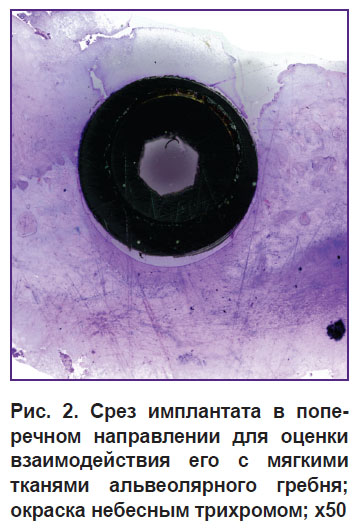 volkov-ris-2.jpg