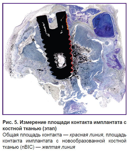 volkov-ris-5.jpg