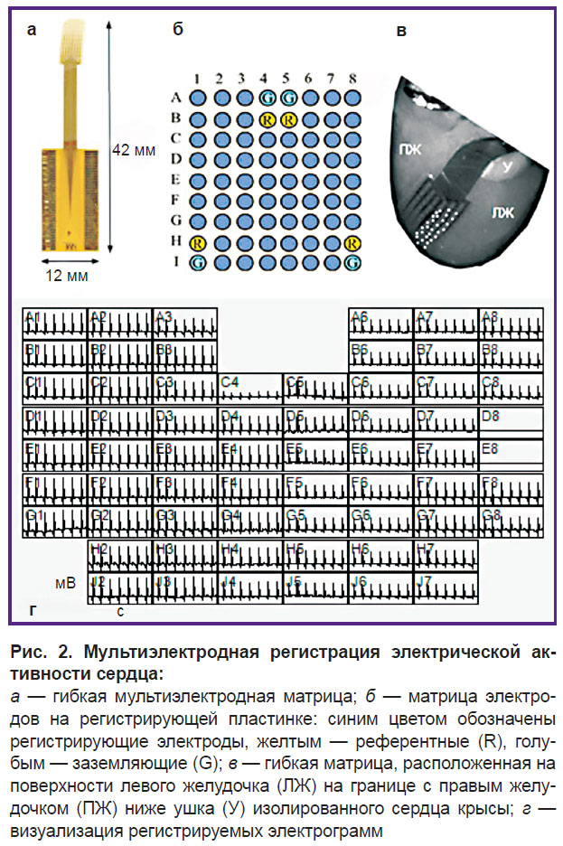 kharkovskaia-ris-2.jpg